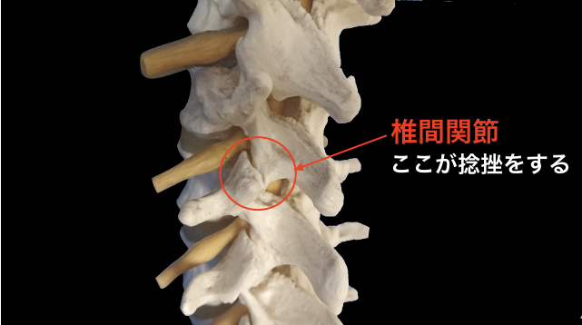 ぎっくり腰で痛める椎間関節の図